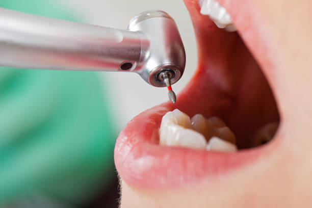 Best Dentist for Tooth Abscess  in Gra Forks, ND